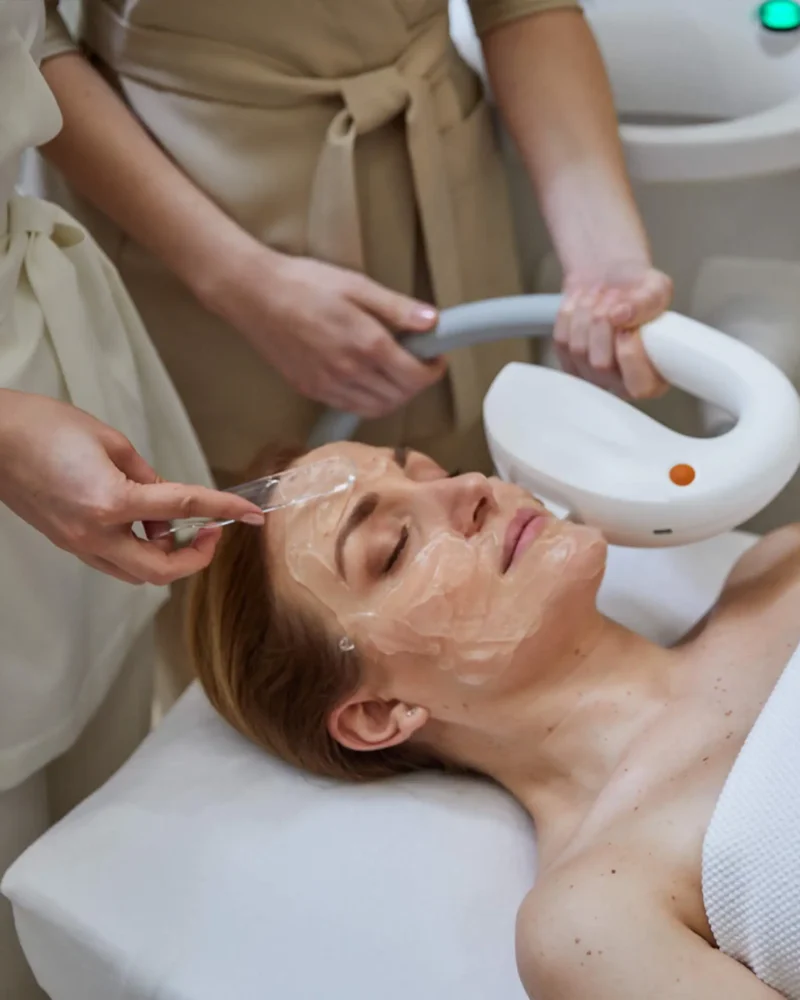 IPL fotorejuvenáció